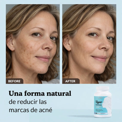 Cápsulas de limpieza de hiperpigmentación